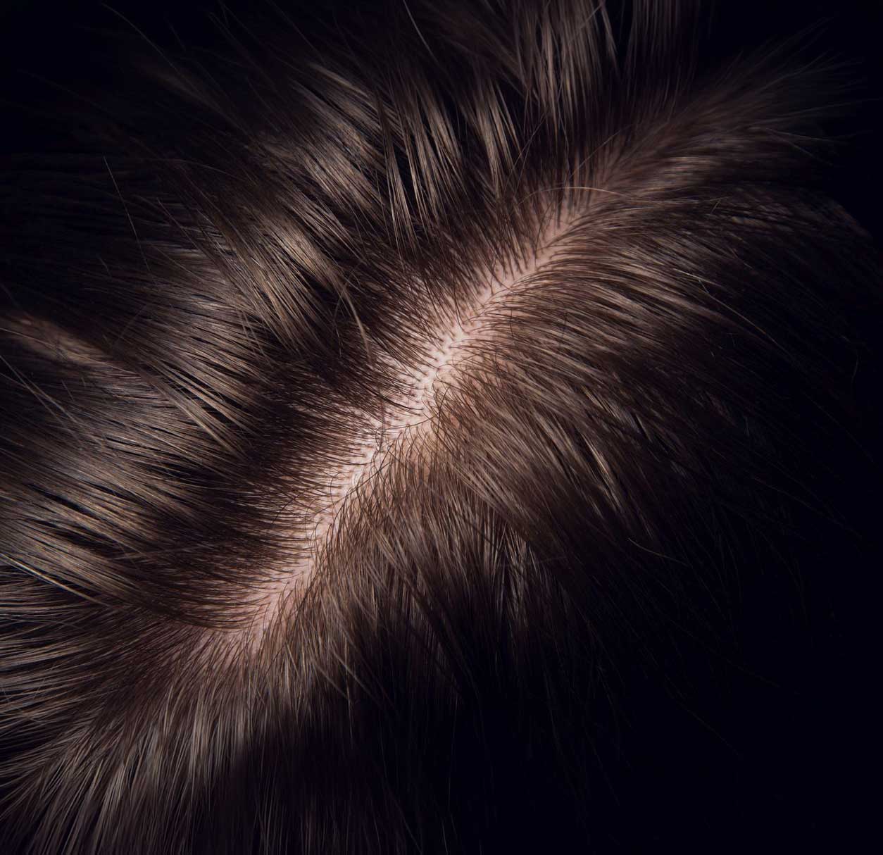 DE|RIVE plant-based hair wellness serum application at Van Scoy Hair Clinics in Ohio