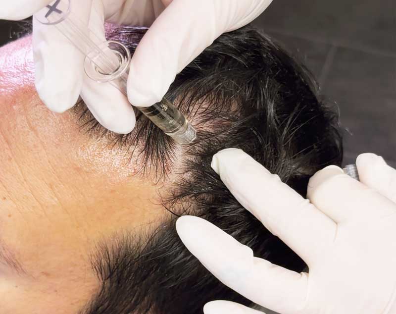 DeRive hair health trichology treatment Cleveland Ohio