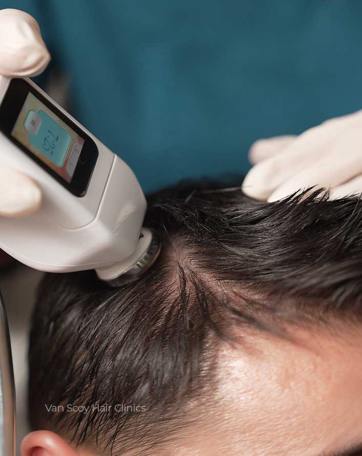 DeRive trichology treatment at Van Scoy hair clinics in cleveland columbus ohio