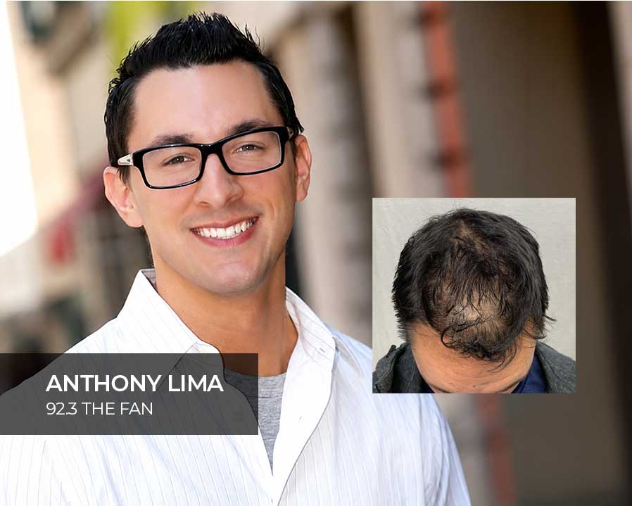 PRP Hair Rejuvination Therapy Anthony Lima 92.3 The Fan Cleveland