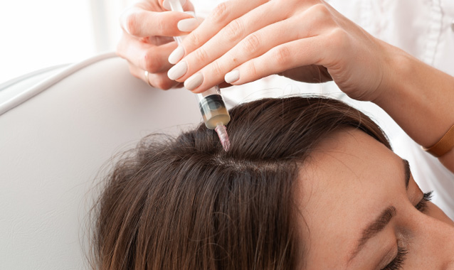 PRP hair regrowth treatment women cleveland columbus ohio