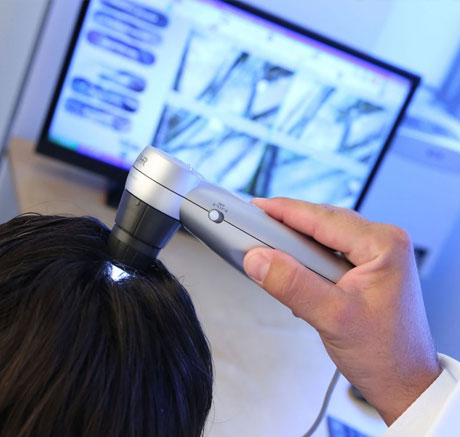 tricologist-hair-and-scalp-evaluation-van-scoy-hair-restoration-ohio Trichological Specialists for healthy Hair and Scalp