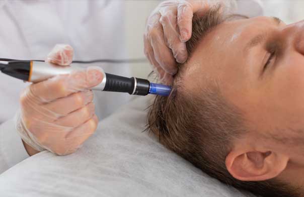 hair regrowth van scoy hair clinics cleveland ashland columbus ohio