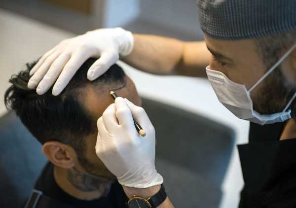 hair transplant procedure what to expect van scoy clinics
