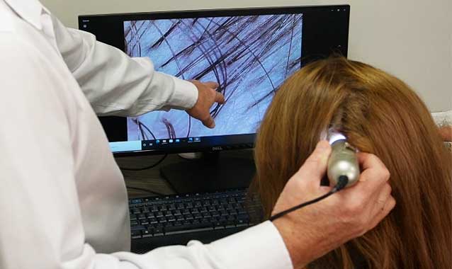 van scoy hair clinics initial consultation scalp health