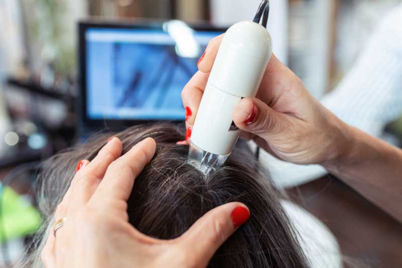 van-scoy-hair-clinics_Hair-Loss-FAQ Van Scoy Hair Clinics Hair Loss Treatment FAQ