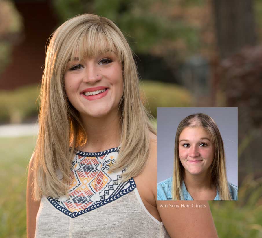 womens-custom-hair-systems-van-scoy-clinic-cleveland-ashland-columbus-ohio womens custom hair systems van scoy clinic cleveland ashland columbus ohio